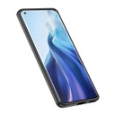 Xiaomi Mi 13 Pro Uyumlu Kılıf Aramid Karbon Fiber Magsafe Özellikli Wlons Radison Kapak - 14