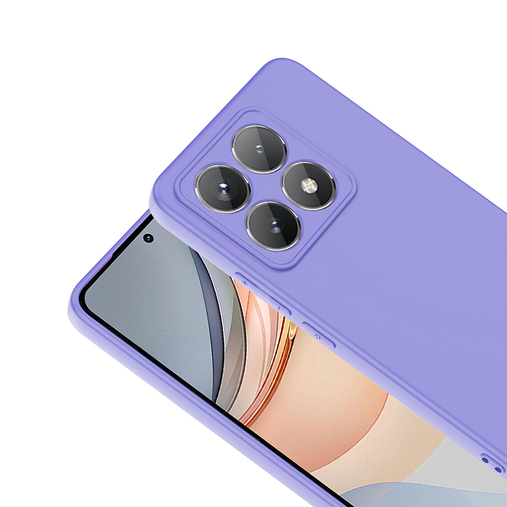 Xiaomi 14T Pro Kılıf Zore Mara Lansman Kapak - 3