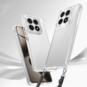 Xiaomi 14T Kılıf Airbagli Takılabilir Askı Aparatlı Zore Snap Silikon Kapak - 1