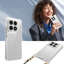 Xiaomi 14T Pro Kılıf Airbagli Takılabilir Askı Aparatlı Zore Snap Silikon Kapak - 7