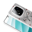 Xiaomi Redmi Note 14 Uyumlu Pro 4G Kılıf Kamera Korumalı Figürlü Zore Ponti Silikon Kapak - 4