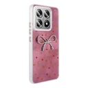 Xiaomi 14T Pro Uyumlu Kılıf Kamera Korumalı Figürlü Zore Ponti Silikon Kapak - 3