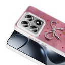 Xiaomi 14T Pro Uyumlu Kılıf Kamera Korumalı Figürlü Zore Ponti Silikon Kapak - 4