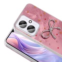 Xiaomi C65 Kılıf Kamera Korumalı Figürlü Zore Ponti Silikon Kapak - 4