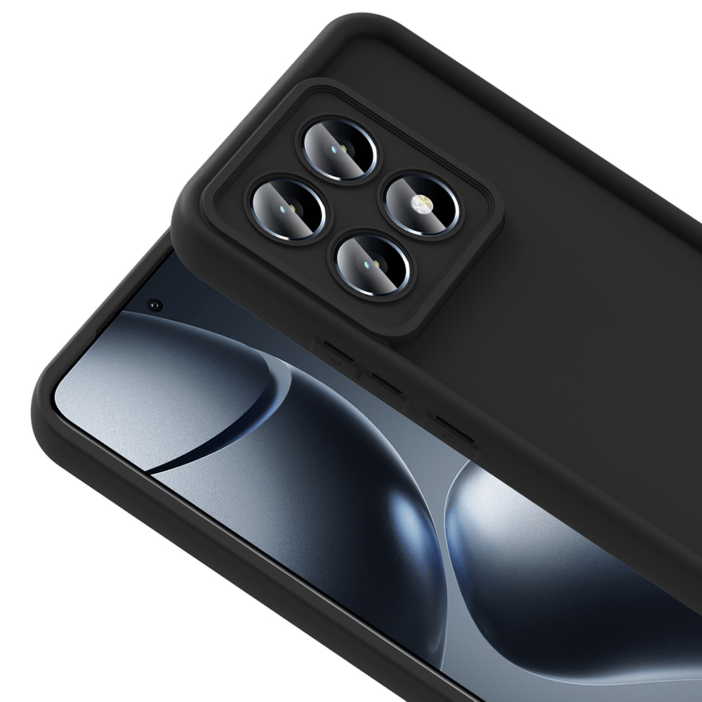 Xiaomi 14T Pro Uyumlu Kılıf Kamera Korumalı Zore Ananas Kapak - 4