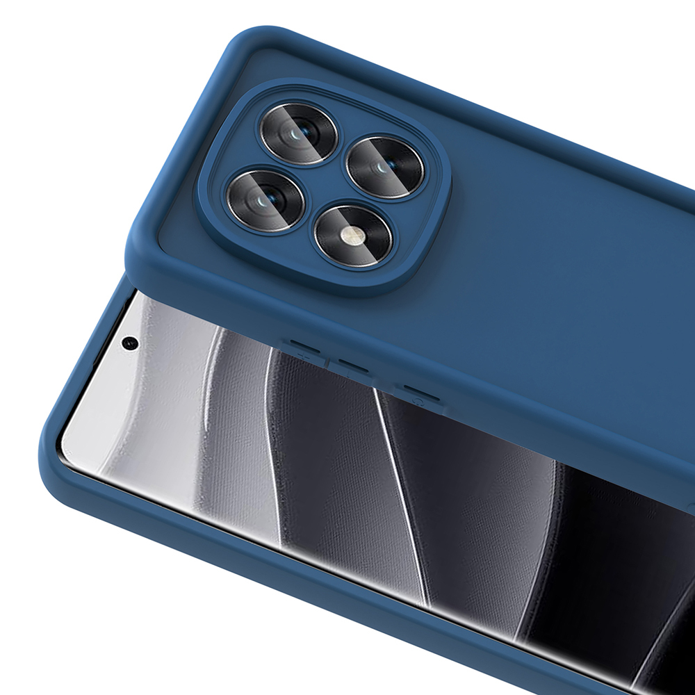 Xiaomi Redmi Note 14 Pro Plus Uyumlu Kılıf Kamera Korumalı Zore Ananas Kapak - 8