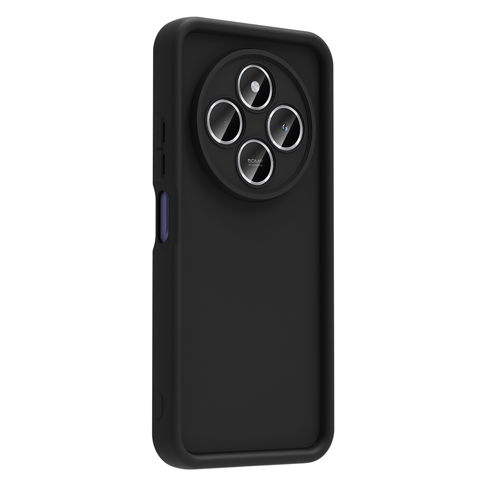 Xiaomi Redmi 14C Uyumlu Kılıf Kamera Korumalı Zore Ananas Kapak - 3