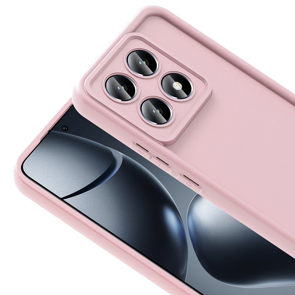 Xiaomi 14T Uyumlu Kılıf Kamera Korumalı Zore Ananas Kapak - 6