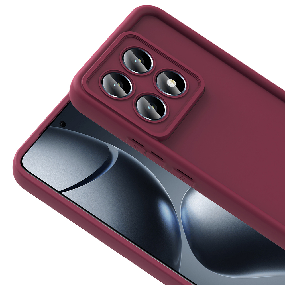 Xiaomi 14T Uyumlu Kılıf Kamera Korumalı Zore Ananas Kapak - 8