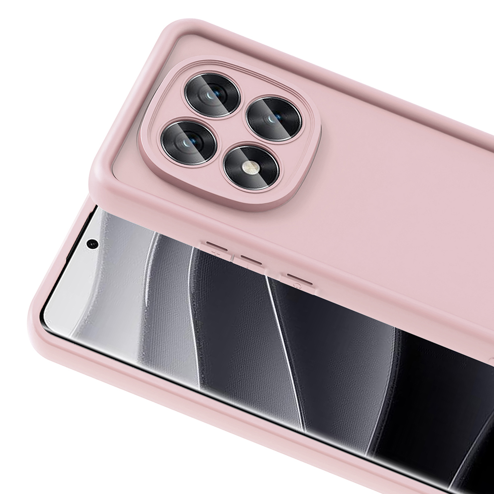 Xiaomi Poco X7 Uyumlu Kılıf Kamera Korumalı Zore Ananas Kapak - 2