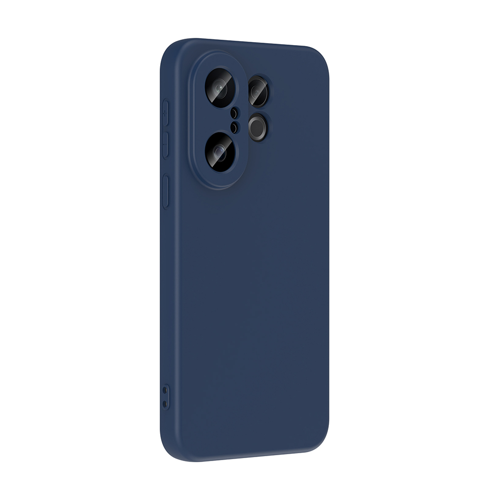Vivo X200 FE 5G Kılıf Zore Mara Lansman Kapak - 4