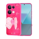 Xiaomi Redmi Note 13 Pro 4G Uyumlu Kılıf Kamera Korumalı Figür Tasarımlı Zore Kapya Kapak - 5