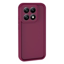 Xiaomi 15 UyumluT Uyumlu Kılıf Kamera Korumalı Zore Ananas Kapak - 1