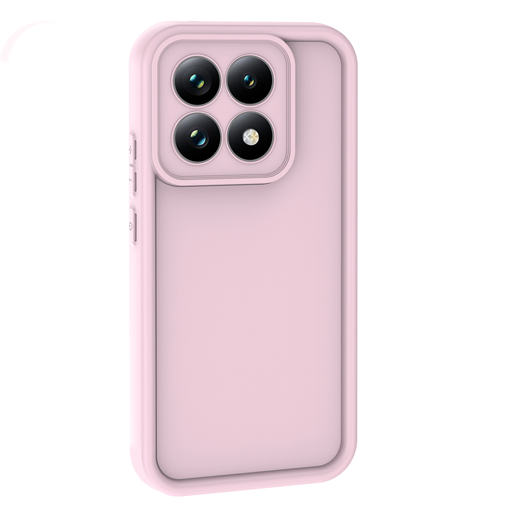 Xiaomi 15 UyumluT Uyumlu Kılıf Kamera Korumalı Zore Ananas Kapak - 3