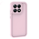 Xiaomi 15 UyumluT Uyumlu Kılıf Kamera Korumalı Zore Ananas Kapak - 3
