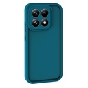 Xiaomi 15 UyumluT Uyumlu Kılıf Kamera Korumalı Zore Ananas Kapak - 4