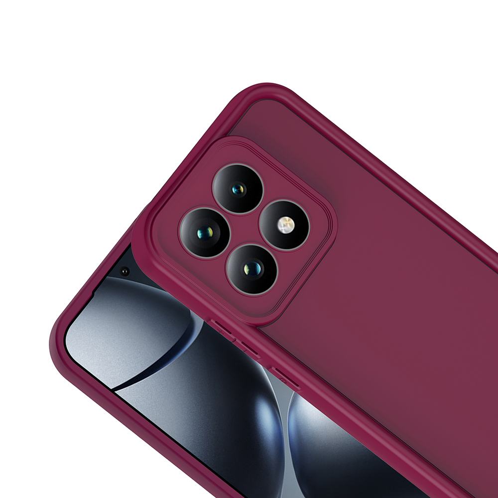 Xiaomi 15 UyumluT Uyumlu Kılıf Kamera Korumalı Zore Ananas Kapak - 5