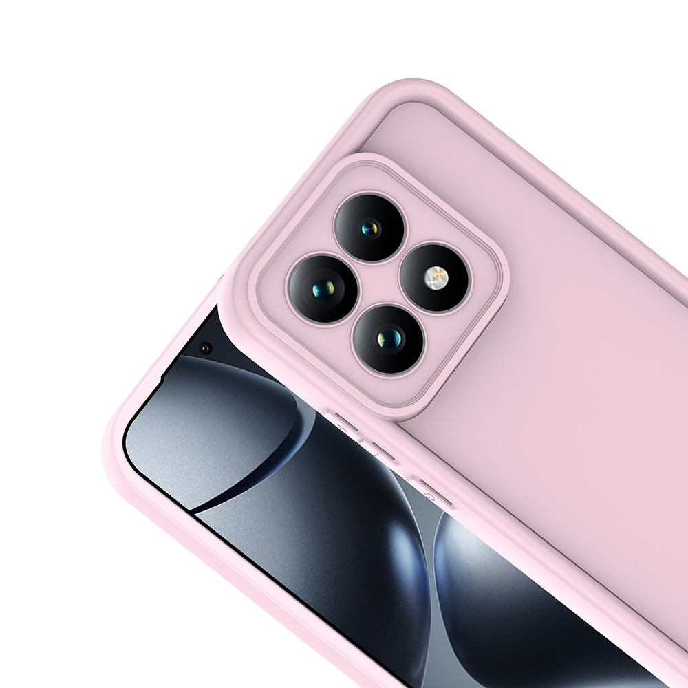 Xiaomi 15 UyumluT Uyumlu Kılıf Kamera Korumalı Zore Ananas Kapak - 7