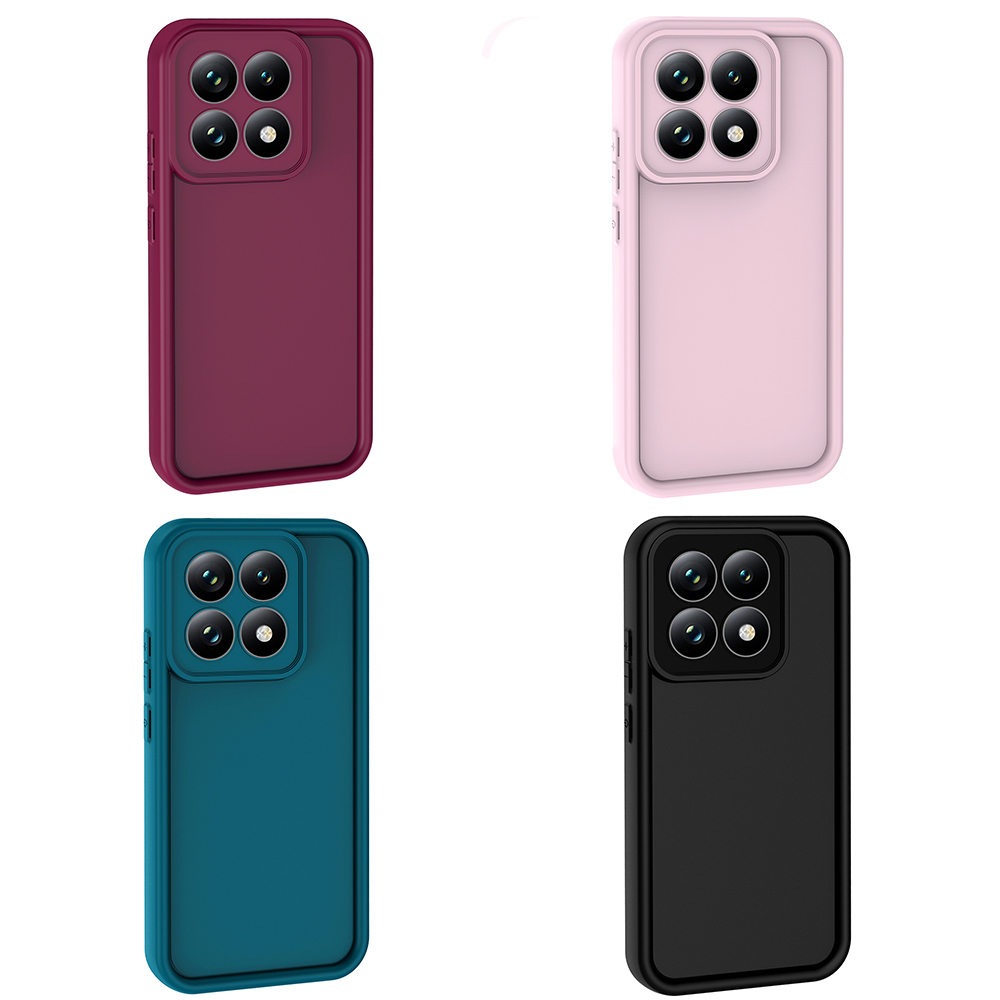 Xiaomi 15 UyumluT Uyumlu Kılıf Kamera Korumalı Zore Ananas Kapak - 9