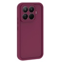 Xiaomi 15 UyumluT Uyumlu Pro Uyumlu Kılıf Kamera Korumalı Zore Ananas Kapak - 1