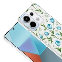 Xiaomi Redmi Note 13 Pro 5G Uyumlu Kılıf Kamera Korumalı Desenli Zore Klip Kapak - 2