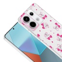 Xiaomi Redmi Note 13 Pro 5G Uyumlu Kılıf Kamera Korumalı Desenli Zore Klip Kapak - 2