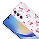 Samsung Galaxy A34 Uyumlu Kılıf Kamera Korumalı Desenli Zore Klip Kapak - 2