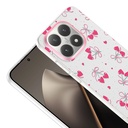 Xiaomi 15T Uyumlu Kılıf Kamera Korumalı Desenli Zore Klip Kapak - 2
