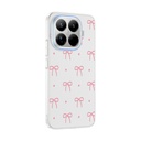 Xiaomi 15T Pro Uyumlu Kılıf Kamera Korumalı Desenli Zore Klip Kapak - 1