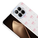 Xiaomi 15T Pro Uyumlu Kılıf Kamera Korumalı Desenli Zore Klip Kapak - 2