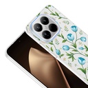 Xiaomi 15T Pro Uyumlu Kılıf Kamera Korumalı Desenli Zore Klip Kapak - 2