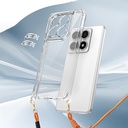 Xiaomi 14T Kılıf Airbagli Takılabilir Askı Aparatlı Zore Snap Silikon Kapak - 5