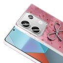 Xiaomi Redmi Note 13 Pro 4G Uyumlu Kılıf Kamera Korumalı Figürlü Zore Ponti Silikon Kapak - 2