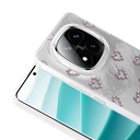 Xiaomi Redmi Note 14 Uyumlu Pro 4G Kılıf Kamera Korumalı Figürlü Zore Ponti Silikon Kapak - 8