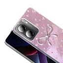 Xiaomi Poco X7 Pro Uyumlu Kılıf Kamera Korumalı Figürlü Zore Ponti Silikon Kapak - 2