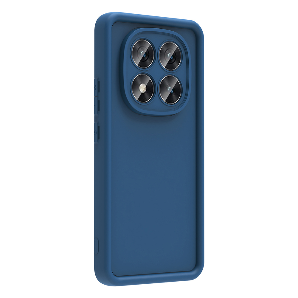 Xiaomi Redmi Note 14 Pro Plus Uyumlu Kılıf Kamera Korumalı Zore Ananas Kapak - 7
