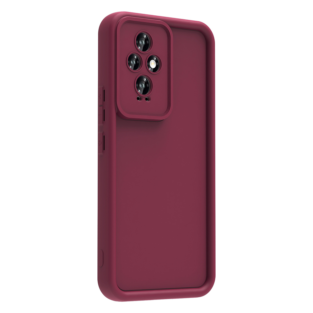 Honor 200 Uyumlu Kılıf Kamera Korumalı Zore Ananas Kapak - 3