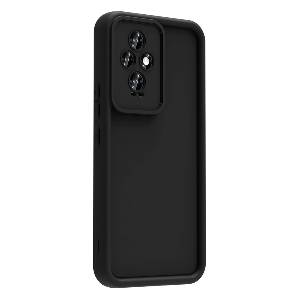 Honor 200 Uyumlu Kılıf Kamera Korumalı Zore Ananas Kapak - 5