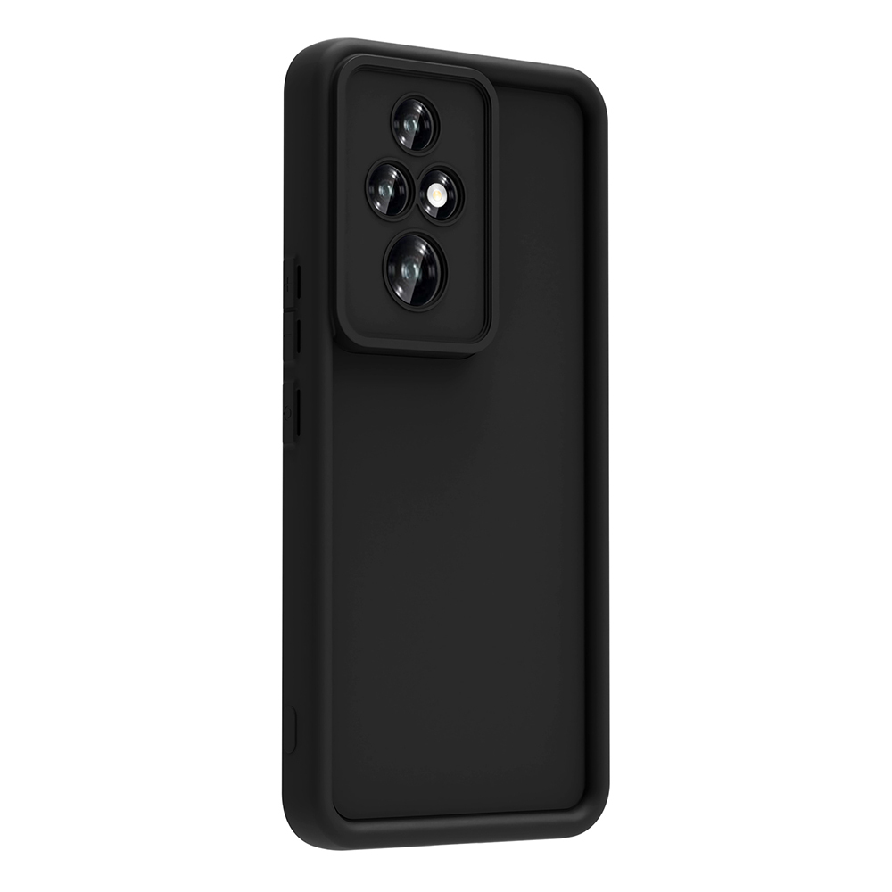 Honor 200 Pro Uyumlu Kılıf Kamera Korumalı Zore Ananas Kapak - 1