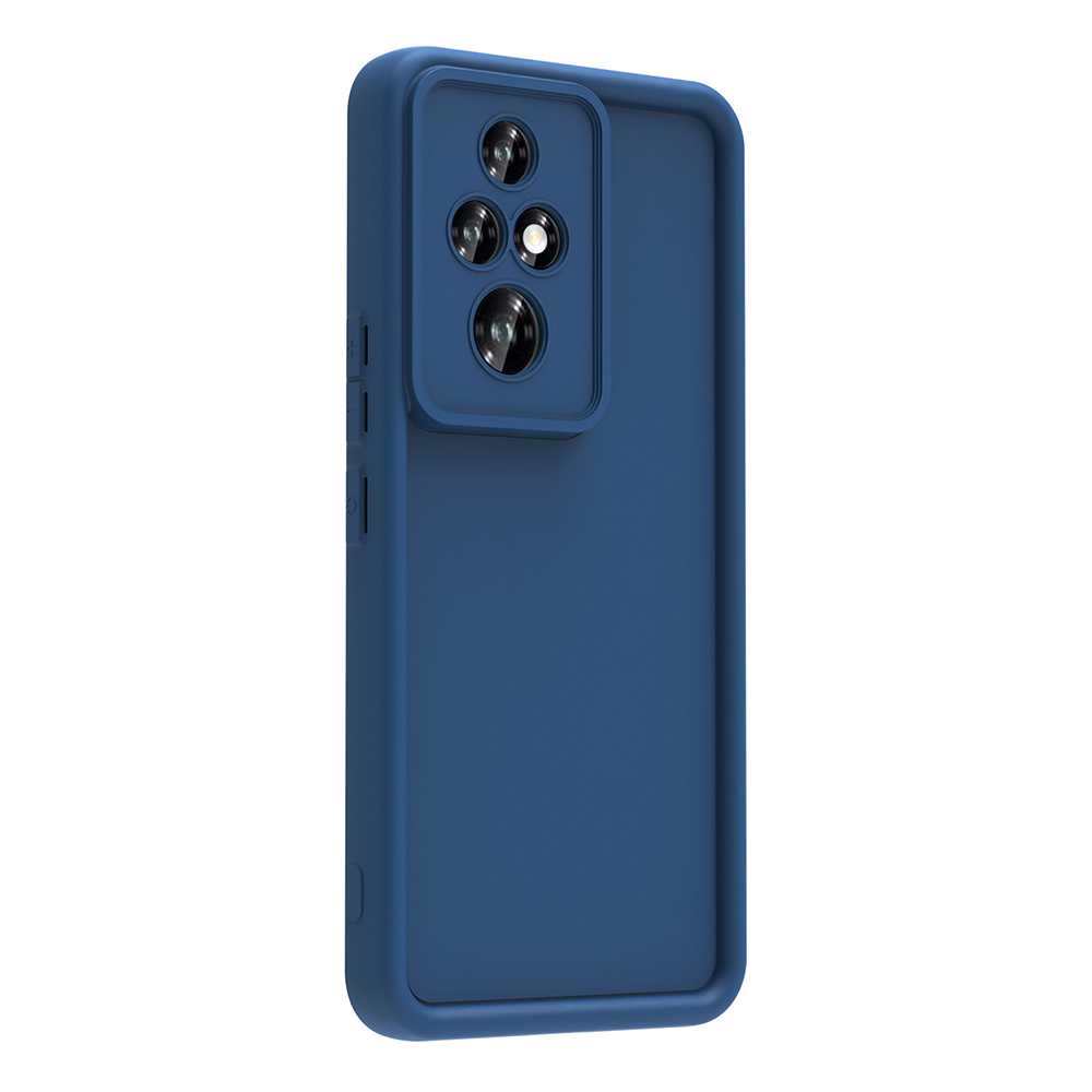 Honor 200 Pro Uyumlu Kılıf Kamera Korumalı Zore Ananas Kapak - 5