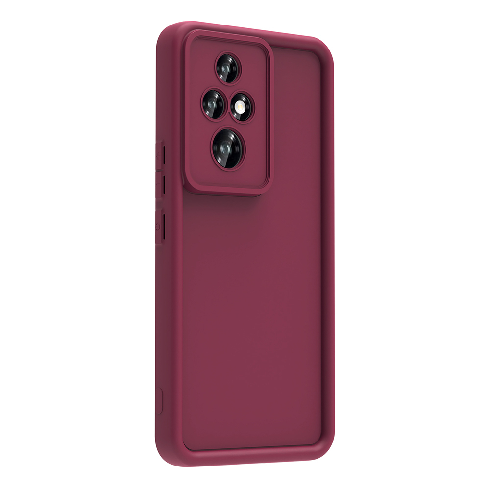 Honor 200 Pro Uyumlu Kılıf Kamera Korumalı Zore Ananas Kapak - 7
