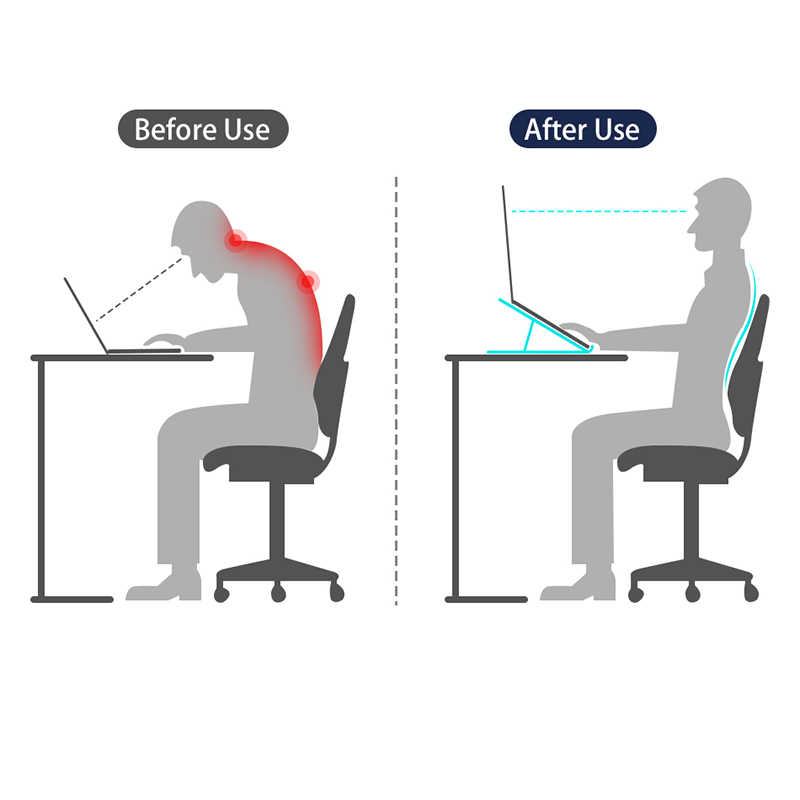 Wiwu S400 Laptop Standı - 9