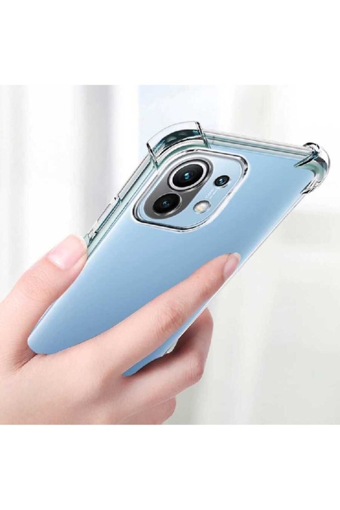 Xiaomi Mi 11 Lite Uyumlu Kılıf Zore Kamera Korumalı Nitro Anti Shock Silikon