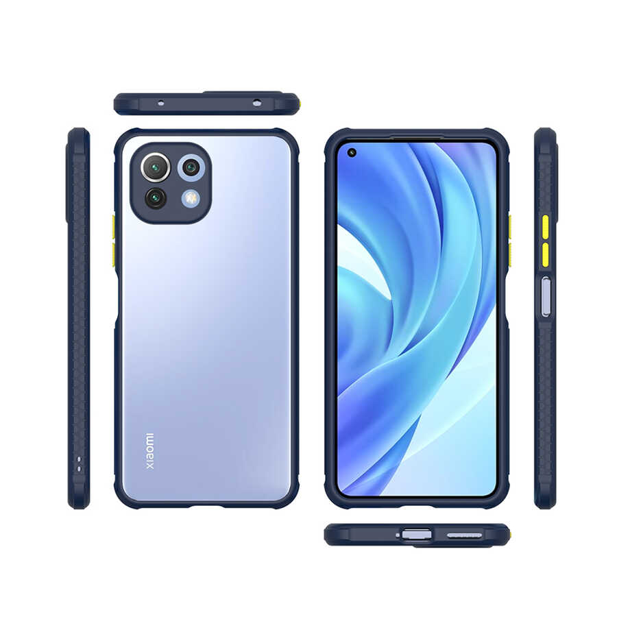 Xiaomi Mi 11 Lite Uyumlu Kılıf ​​Zore Kaff Kapak - 10