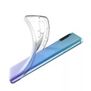 OnePlus Nord N10 5G Uyumlu Kılıf Zore Süper Silikon Kapak - 3