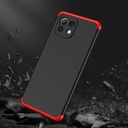 Xiaomi Mi 11 Lite Uyumlu Kılıf Zore Ays Kapak - 5