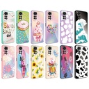 Xiaomi Redmi Note 11 Global Uyumlu Kılıf Kamera Korumalı Desenli Sert Silikon Zore Epoksi Kapak - 1