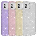 Samsung Galaxy A03 Uyumlu Kılıf Zore Shining Silikon - 1