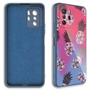 Xiaomi Redmi Note 10 Pro Uyumlu Kılıf Kamera Korumalı Desenli Sert Silikon Zore Epoksi Kapak - 1