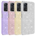 Xiaomi Redmi Note 12 Pro 4G Uyumlu Kılıf Zore Shining Silikon - 1